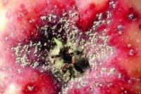 cochenille ostréiforme (dégât sur fruit)